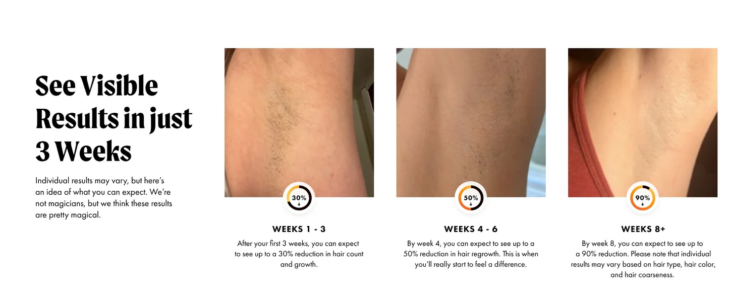 IPL Hair Removal Laser 999999 Flashes