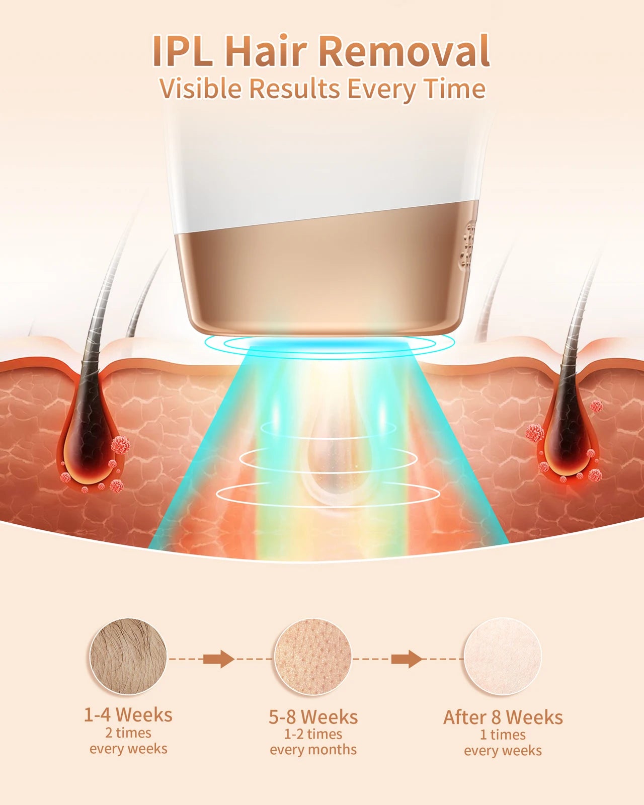 IPL Hair Removal Laser 999999 Flashes